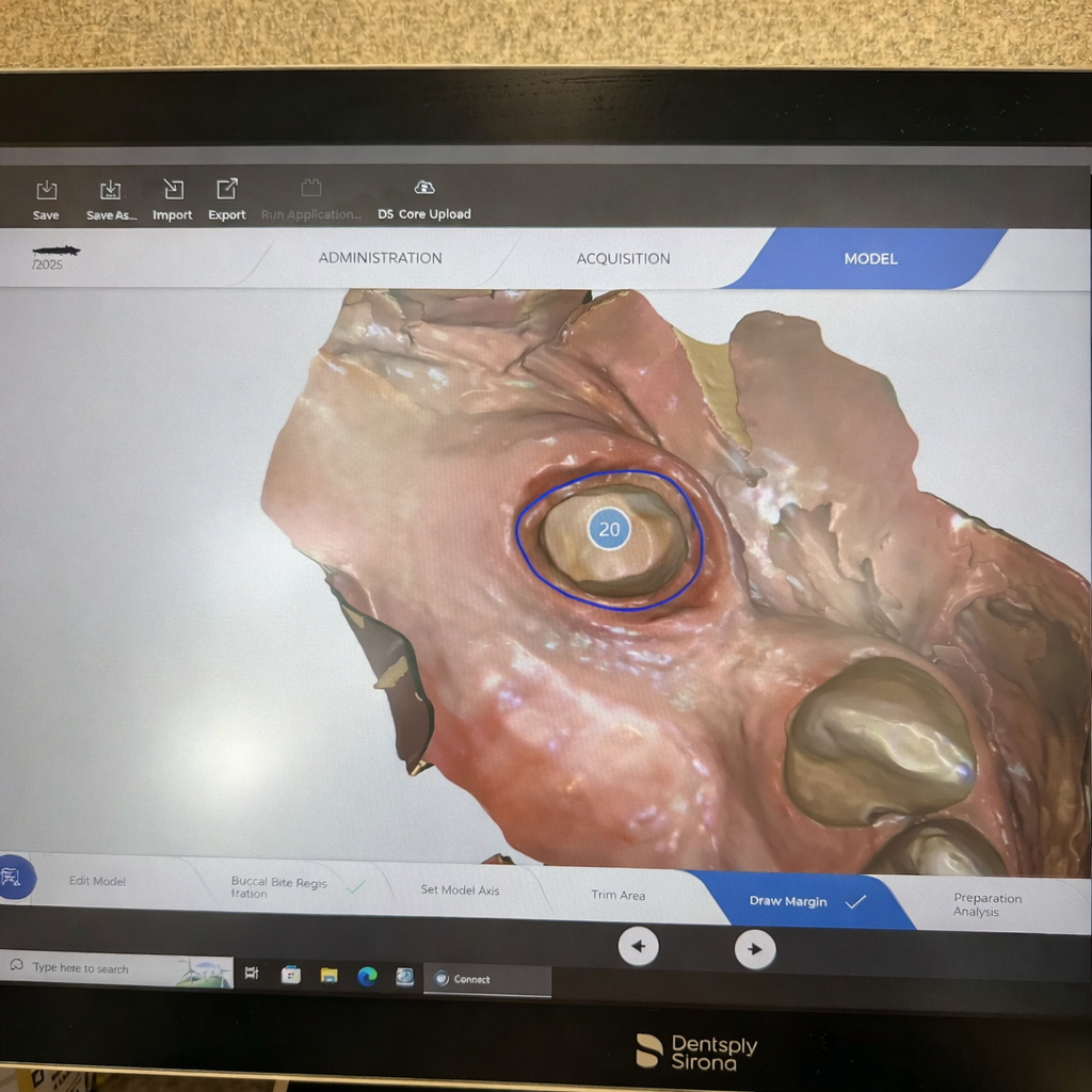 Sirona CEREC PrimeScan Scanner