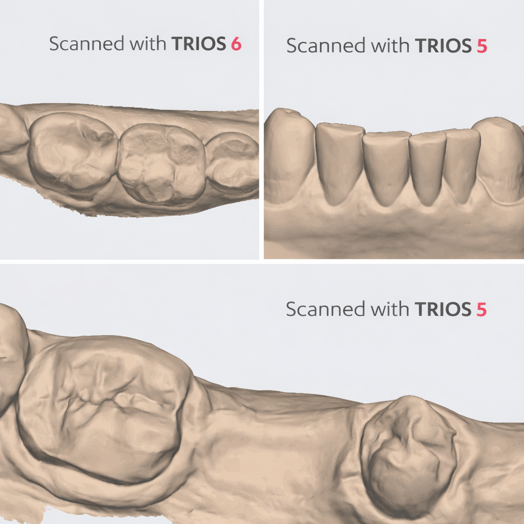 3Shape TRIOS 6 Wireless Intraoral Scanner (New)